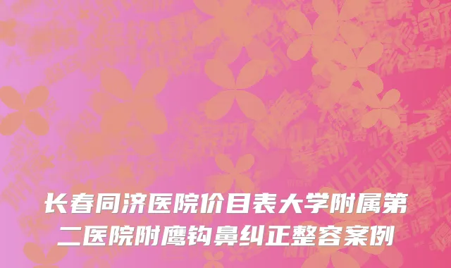 长春同济医院价目表大学附属第二医院附鹰钩鼻纠正整容案例