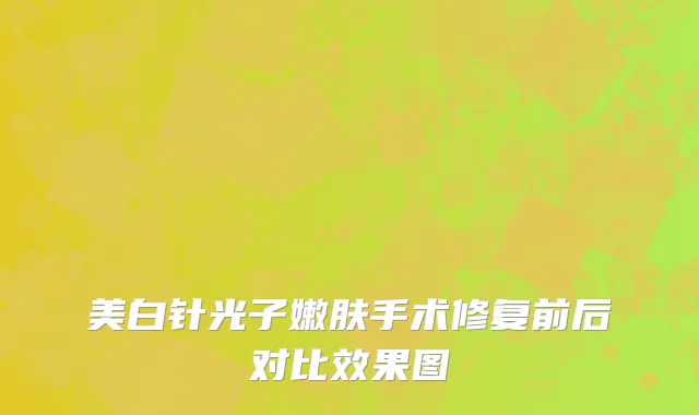 美白针光子嫩肤手术修复前后对比效果图