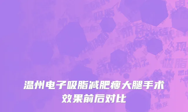 温州电子吸脂减肥瘦大腿手术效果前后对比