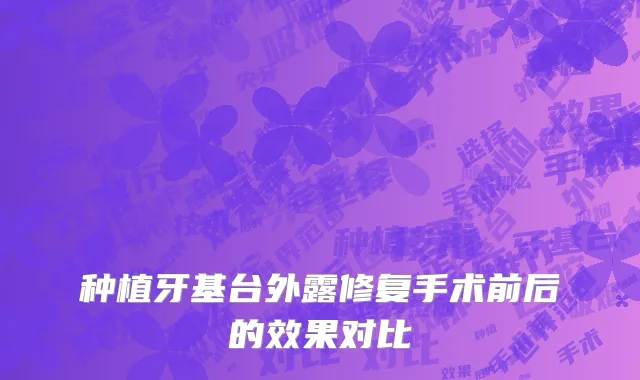 种植牙基台外露修复手术前后的效果对比