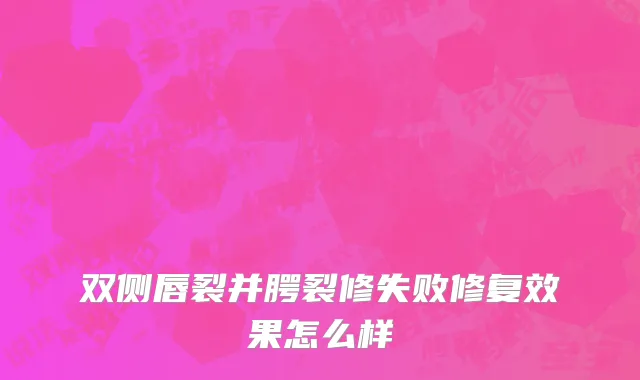 双侧唇裂并腭裂修失败修复效果怎么样