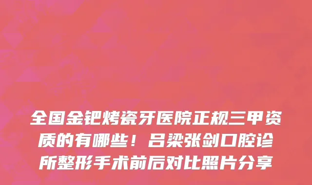 全国金钯烤瓷牙医院正规三甲资质的有哪些！吕梁张剑口腔诊所整形手术前后对比照片分享