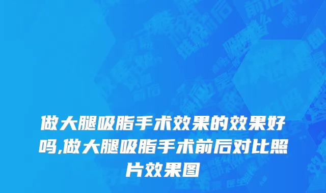 做大腿吸脂手术效果的效果好吗,做大腿吸脂手术前后对比照片效果图