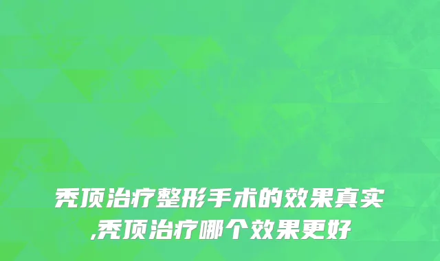 秃顶治疗整形手术的效果真实,秃顶治疗哪个效果更好