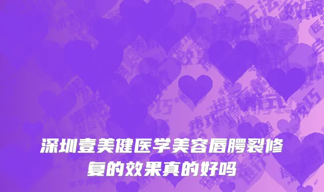 深圳壹美健医学美容唇腭裂修复的效果真的好吗