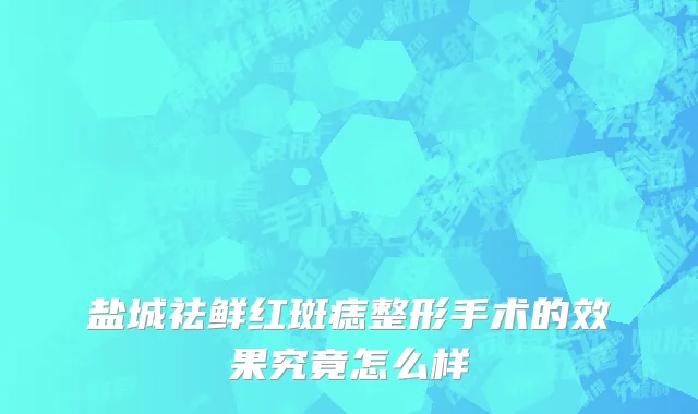 盐城祛鲜红斑痣整形手术的效果究竟怎么样