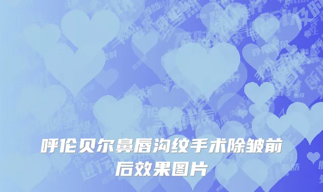 呼伦贝尔鼻唇沟纹手术除皱前后效果图片