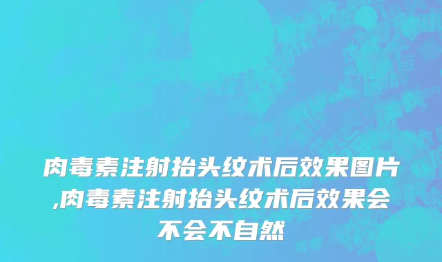 肉毒素注射抬头纹术后效果图片,肉毒素注射抬头纹术后效果会不会不自然